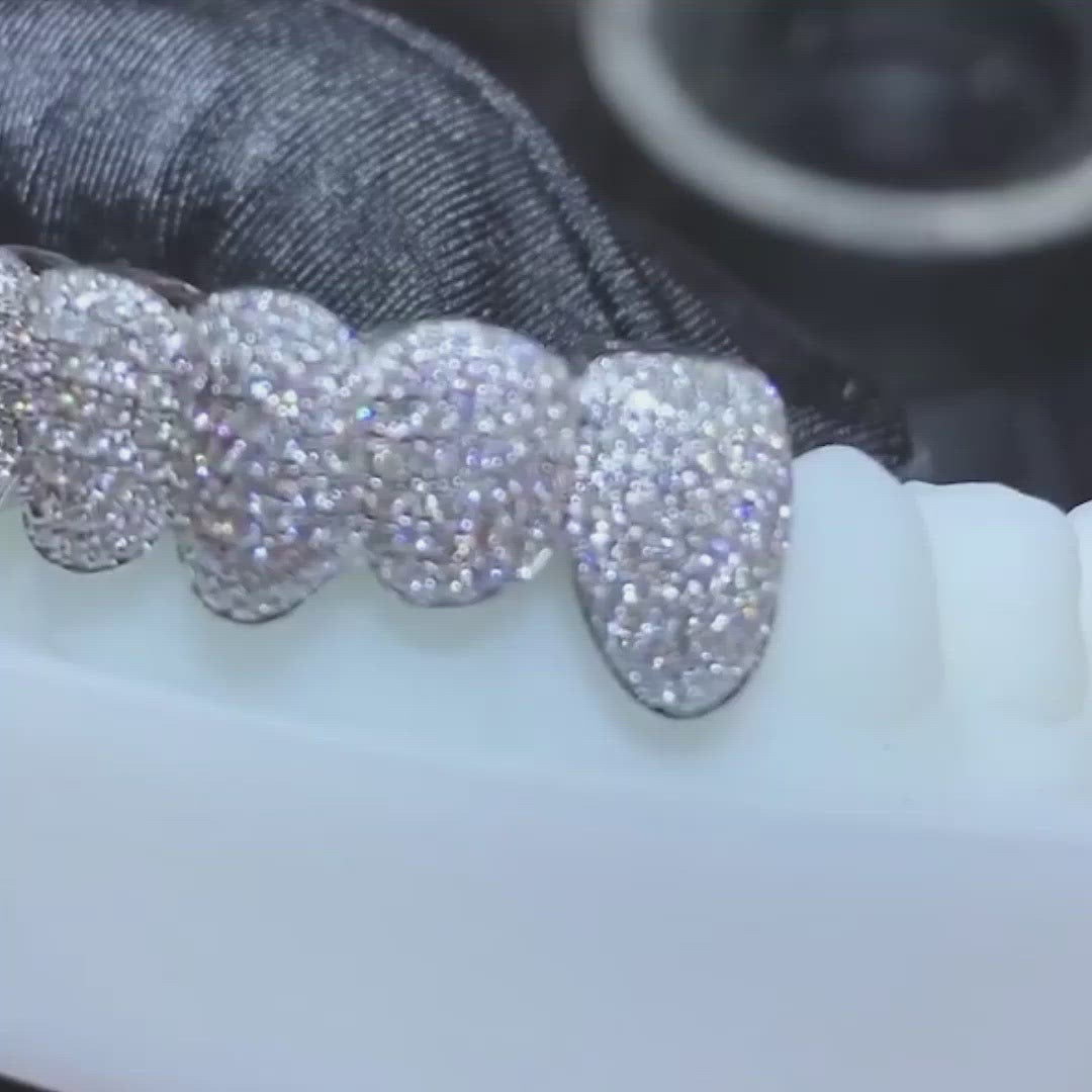 Custom Fully Iced Out Perm Cut Grillz